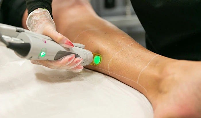 The Growing Trend of Laser Hair Removal for Legs | by AZ Laser Studio | Apr, 2024 | Medium