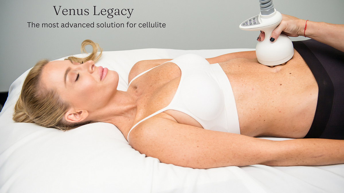 Venus Legacy Revolutionizing Non-Invasive Cellulite Treatment | by AZ Laser Studio | Apr, 2024 | Medium